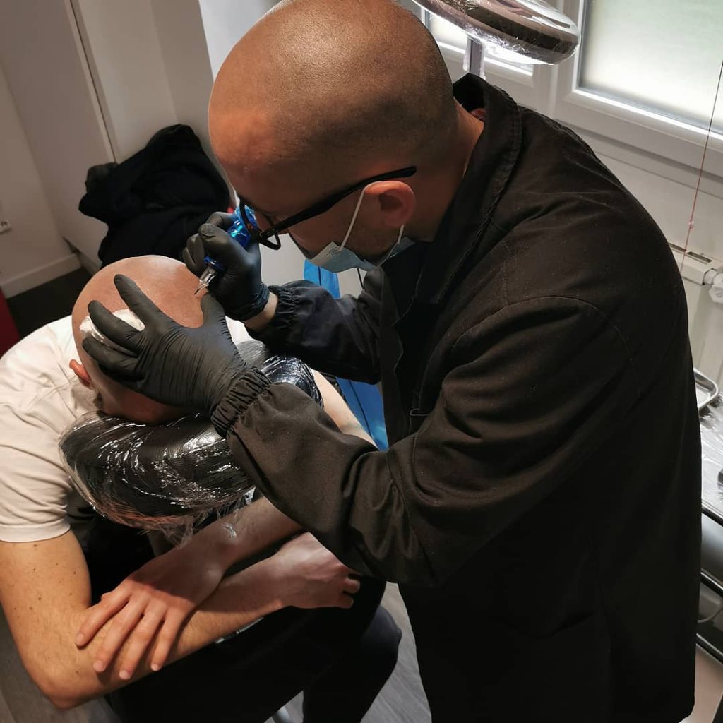 Séance de dermopigmentation capillaire par Nicolas DPC
