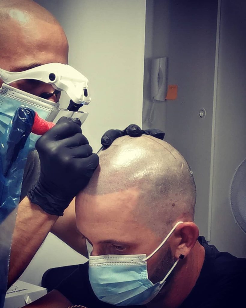 Qu'est ce que la dermopigmentation ? Découvrez la technique avec Nicolas DPC, expert en dermopigmentation